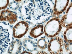 MAOA Rabbit anti-Human, Polyclonal, Proteintech:Antibodies:Primary Antibodies