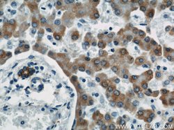 MAOA Rabbit anti-Human, Polyclonal, Proteintech:Antibodies:Primary Antibodies