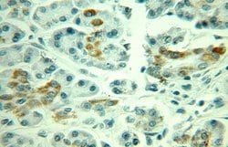 MAOA Rabbit anti-Human, Polyclonal, Proteintech:Antibodies:Primary Antibodies