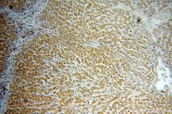 MAOA Rabbit anti-Human, Polyclonal, Proteintech:Antibodies:Primary Antibodies