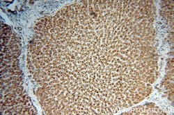 MAOA Rabbit anti-Human, Polyclonal, Proteintech:Antibodies:Primary Antibodies
