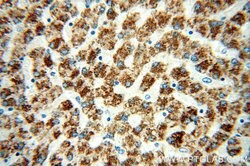 MAOA Rabbit anti-Human, Polyclonal, Proteintech:Antibodies:Primary Antibodies