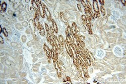 MAOA Rabbit anti-Human, Polyclonal, Proteintech:Antibodies:Primary Antibodies