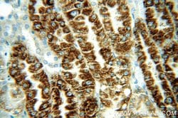 MAOA Rabbit anti-Human, Polyclonal, Proteintech:Antibodies:Primary Antibodies