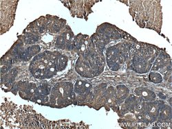 MAOA Rabbit anti-Human, Polyclonal, Proteintech:Antibodies:Primary Antibodies