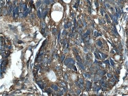 MAOA Rabbit anti-Human, Polyclonal, Proteintech:Antibodies:Primary Antibodies