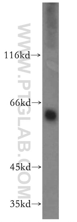 MAOA Rabbit anti-Human, Polyclonal, Proteintech:Antibodies:Primary Antibodies