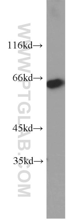 MAOA Rabbit anti-Human, Polyclonal, Proteintech:Antibodies:Primary Antibodies