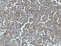 PSME1 Rabbit anti-Human, Mouse, Rat, Polyclonal, Proteintech 150 &mu;L;