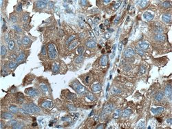 PSME1 Rabbit anti-Human, Mouse, Rat, Polyclonal, Proteintech 150 &mu;L;