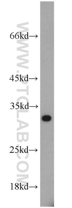 PSME1 Rabbit anti-Human, Mouse, Rat, Polyclonal, Proteintech 150 &mu;L;