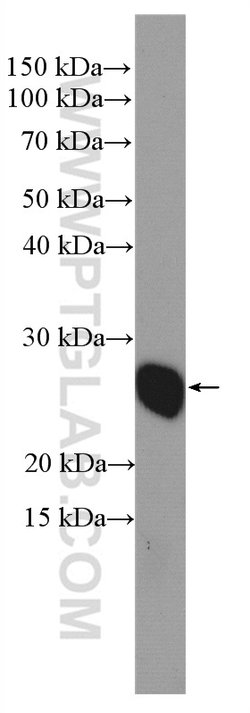 TAF9 Rabbit anti-Human, Mouse, Rat, Polyclonal, Proteintech:Antibodies:Primary