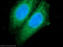 IRF5 Rabbit anti-Human, Mouse, Rat, Polyclonal, Proteintech 150 &mu;L;