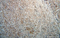 IRF5 Rabbit anti-Human, Mouse, Rat, Polyclonal, Proteintech 150 &mu;L;