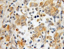 IRF5 Rabbit anti-Human, Mouse, Rat, Polyclonal, Proteintech 150 &mu;L;
