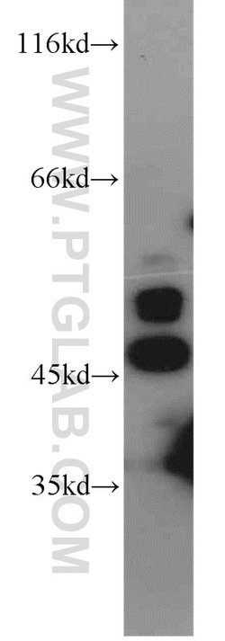 IRF5 Rabbit anti-Human, Mouse, Rat, Polyclonal, Proteintech 150 &mu;L;