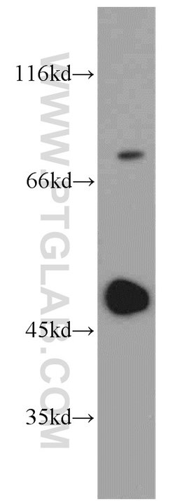 IRF5 Rabbit anti-Human, Mouse, Rat, Polyclonal, Proteintech 150 &mu;L;