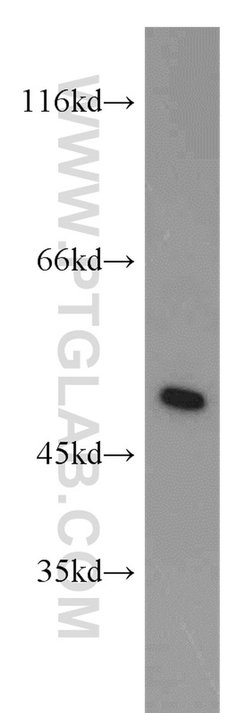 IRF5 Rabbit anti-Human, Mouse, Rat, Polyclonal, Proteintech 150 &mu;L;