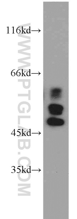 IRF5 Rabbit anti-Human, Mouse, Rat, Polyclonal, Proteintech 150 &mu;L;