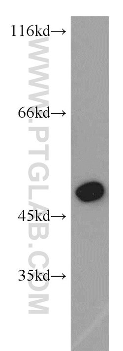 IRF5 Rabbit anti-Human, Mouse, Rat, Polyclonal, Proteintech 150 &mu;L;