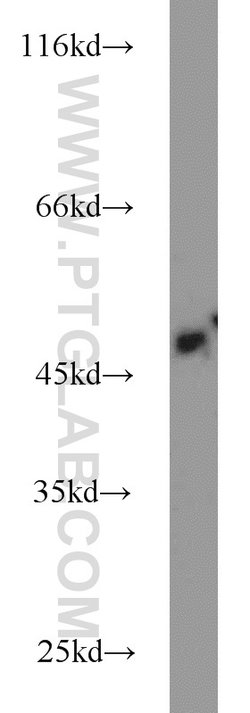 IRF5 Rabbit anti-Human, Mouse, Rat, Polyclonal, Proteintech 150 &mu;L;