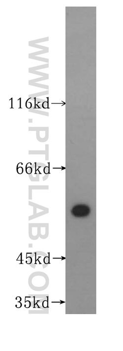 IRF5 Rabbit anti-Human, Mouse, Rat, Polyclonal, Proteintech 150 &mu;L;