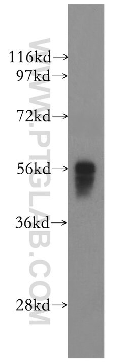 IRF5 Rabbit anti-Human, Mouse, Rat, Polyclonal, Proteintech 150 &mu;L;