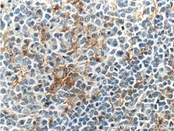 CD18 Rabbit anti-Human, Mouse, Polyclonal, Proteintech 150 &mu;L; Unconjugated:Antibodies,