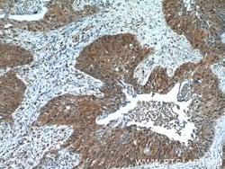 NCL Rabbit anti-Human, Mouse, Rat, Polyclonal, Proteintech:Antibodies:Primary