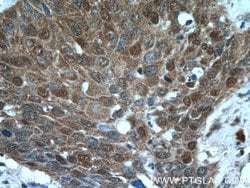 NCL Rabbit anti-Human, Mouse, Rat, Polyclonal, Proteintech:Antibodies:Primary