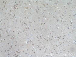 ITPK1 Rabbit anti-Human, Mouse, Polyclonal, Proteintech:Antibodies:Primary