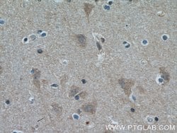 ITPK1 Rabbit anti-Human, Mouse, Polyclonal, Proteintech:Antibodies:Primary