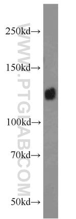 Thumbnail_Integrin alpha-5 Rabbit anti-Human, Mouse, Non-human primate, Polyclonal,