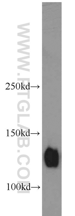 Integrin alpha-5 Rabbit anti-Human, Mouse, Non-human primate, Polyclonal,
