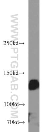 Thumbnail_Integrin alpha-5 Rabbit anti-Human, Mouse, Non-human primate, Polyclonal,