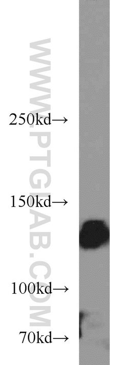 Integrin alpha-5 Rabbit anti-Human, Mouse, Non-human primate, Polyclonal,