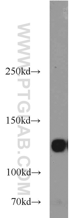 Integrin alpha-5 Rabbit anti-Human, Mouse, Non-human primate, Polyclonal,