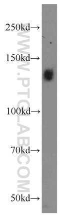 Thumbnail_Integrin alpha-5 Rabbit anti-Human, Mouse, Non-human primate, Polyclonal,