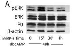 MPZ/P0 Rabbit anti-Human, Mouse, Rat, Polyclonal, Proteintech:Antibodies:Primary