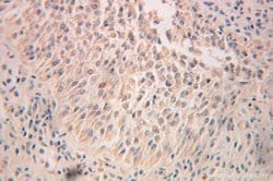 RPN2 Rabbit anti-Human, Mouse, Rat, Polyclonal, Proteintech:Antibodies:Primary