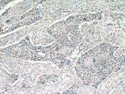POT1 Rabbit anti-Human, Mouse, Polyclonal, Proteintech 150 &mu;L; Unconjugated:Antibodies,