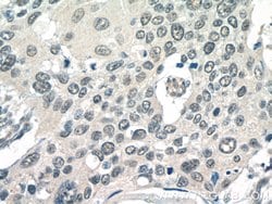 POT1 Rabbit anti-Human, Mouse, Polyclonal, Proteintech 150 &mu;L; Unconjugated:Antibodies,