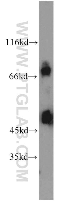 POT1 Rabbit anti-Human, Mouse, Polyclonal, Proteintech 150 &mu;L; Unconjugated:Antibodies,