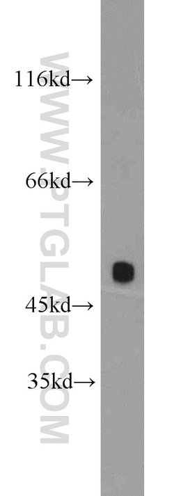 POT1 Rabbit anti-Human, Mouse, Polyclonal, Proteintech 150 &mu;L; Unconjugated:Antibodies,