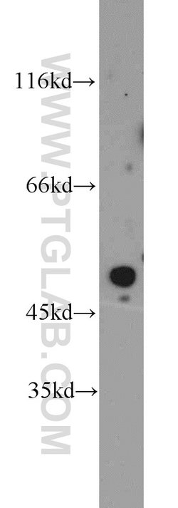 POT1 Rabbit anti-Human, Mouse, Polyclonal, Proteintech 150 &mu;L; Unconjugated:Antibodies,