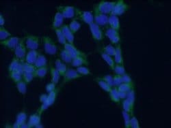 TRAPA/SSR1 Rabbit anti-Human, Polyclonal, Proteintech:Antibodies:Primary