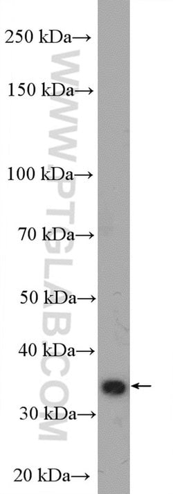 TRAPA/SSR1 Rabbit anti-Human, Polyclonal, Proteintech:Antibodies:Primary