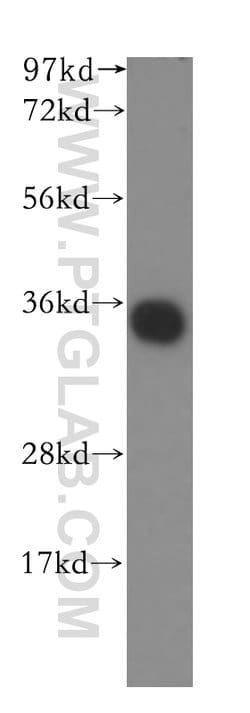 TRAPA/SSR1 Rabbit anti-Human, Polyclonal, Proteintech:Antibodies:Primary