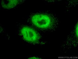 RBM15 Rabbit anti-Human, Mouse, Rat, Polyclonal, Proteintech 150 &mu;L;