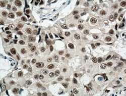 RBM15 Rabbit anti-Human, Mouse, Rat, Polyclonal, Proteintech 150 &mu;L;